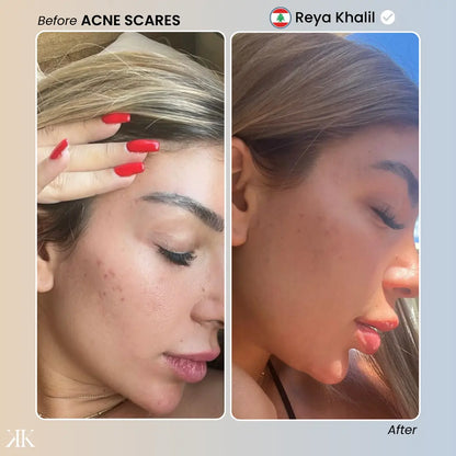 Kanz™ Instant Skin Glow LED Mask KANZ